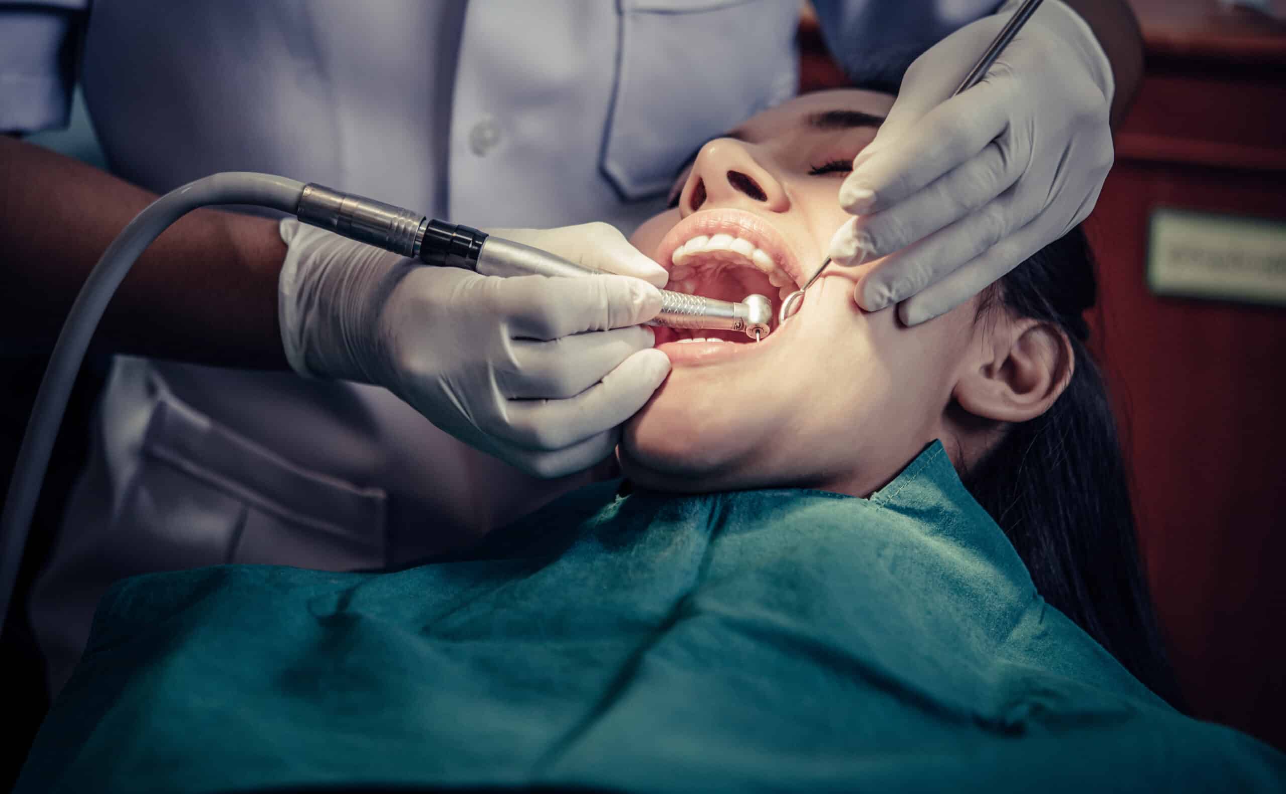 Chirurgie dentară